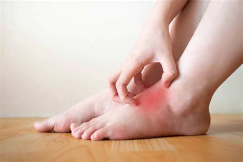 Diabetic Foot Rash Symptoms and Treatment | Fresno and Visalia Podiatry