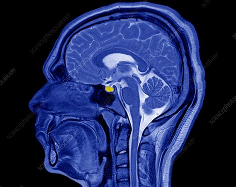 Head, brain and pituitary gland, MRI scan - Stock Image - C037/3115 ...