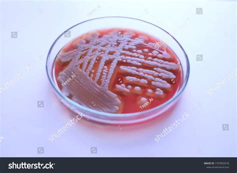 Bacillus Cereus Colony Morphology On Blood Stock Photo 1707802918 ...