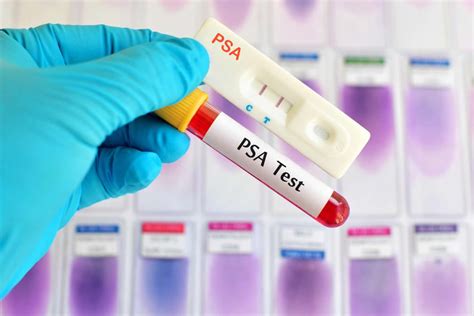 PSA Test - Results, Elevated Psa Levels & Normal Psa Levels By Age