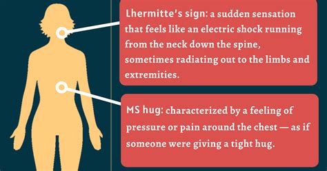 Dysesthesia in MS | Feeling, Causes, and Treatment | Multiple Sclerosis ...