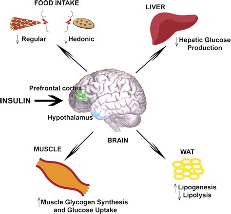 Poor Memory - How Is It Linked to High Blood Sugar? | GetDocSays