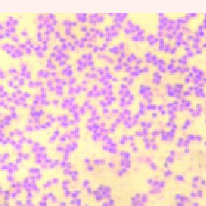 Methylene blue staining. | Download Scientific Diagram