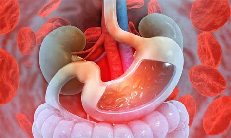 Understanding Gastrointestinal Bleeding: Causes and Symptoms