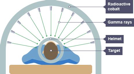 Cancer Therapy: How Are Gamma Rays Used In Cancer Therapy