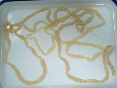 Chinese sushi-lover infected with multiple tapeworms after eating raw ...