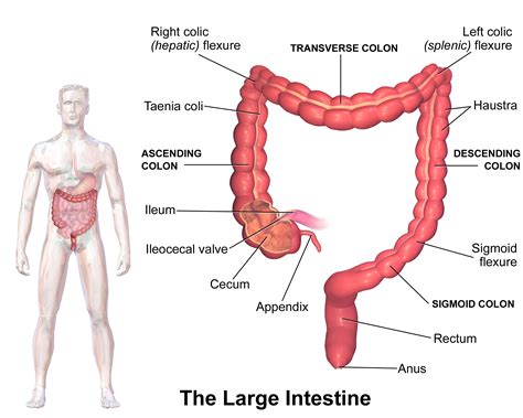 ICV-probably the most contributing factor in poor health