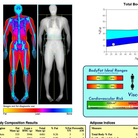 How to read a DEXA Scan - The Food TeacherThe Food Teacher