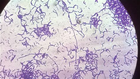 Lactobacillus Acidophilus Gram Stain