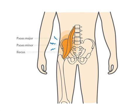 What is Hip Flexor Strain & How to Recover from It? - Upswing Health