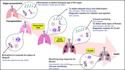 Markers of rejection of the lung allograft. | Download Scientific Diagram