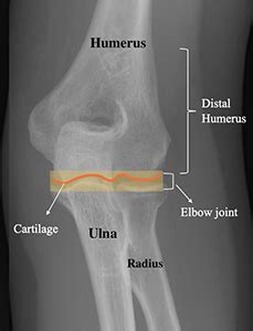 Distal Humerus Anatomy