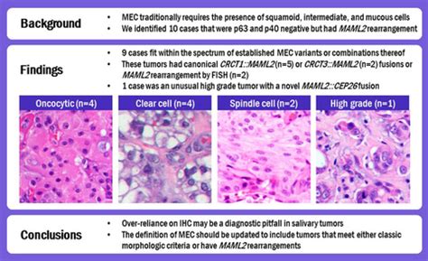 Mucoepidermoid carcinoma may be devoid of squamoid cells by ...