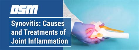 Synovitis: Causes and Treatments of Joint Inflammation - Orthopedic ...