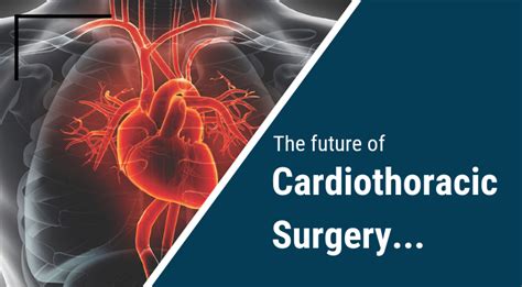 The Basics About Cardiothoracic Surgery