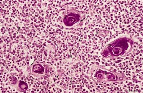 Corpuscles in thymus (human, puberty) - POJA Collection Microscopic Anatomy