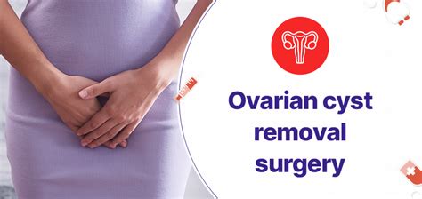 Ovarian Cyst Removal Surgery In Hyderabad: What to expect - Gmoney.in