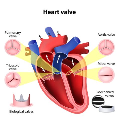 Types of Mechanical Heart Valves | Dr. Ciuffo Heart Surgery