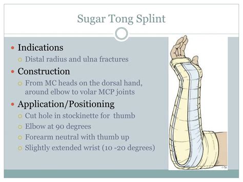 PPT - Procedures: Splinting PowerPoint Presentation, free download - ID ...