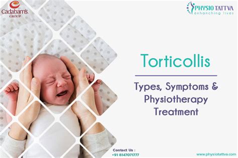 Torticollis | Types, Symptoms & Physiotherapy Treatment