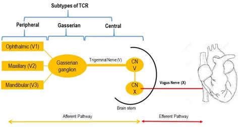 Brainstem Reflexes During Neurosurgery: An Overview : Virtual Library