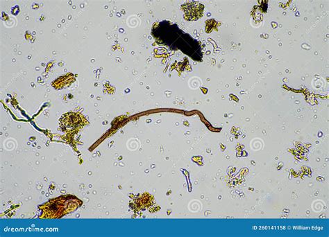 Soil Sample Under the Microscope. Soil Fungi and Microorganisms Cycling ...