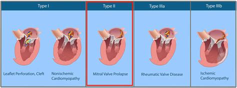 Transesophageal Echocardiographic Assessment of the Repaired Mitral ...