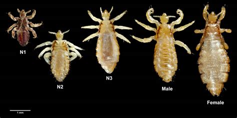 Body Lice - What Does Body Lice Look Like? - Symptoms & Treatment