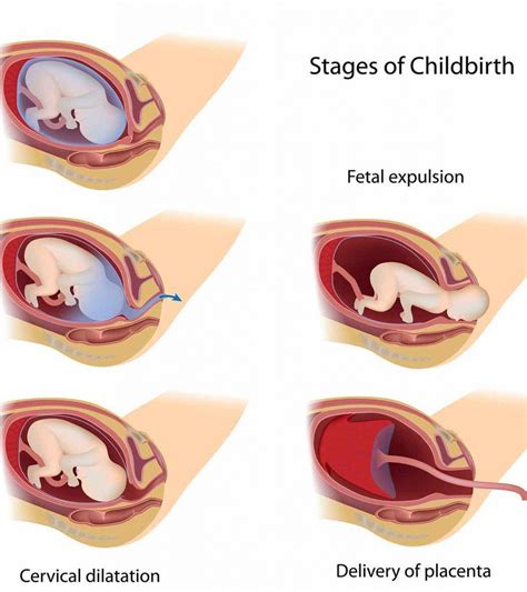 3 Vital Stages Of Labor: What Happens In Them And What To Do