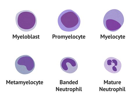 Immature Granulocytes | Blood Film - MedSchool