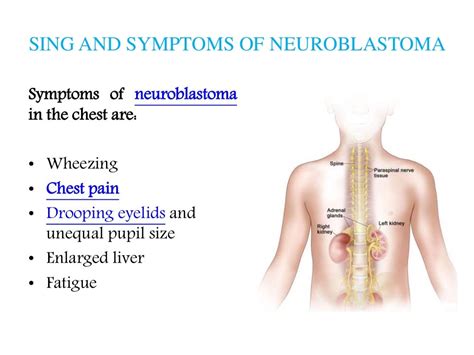 Neuroblastoma: Patient info on symptoms, diagnosis and treatment options