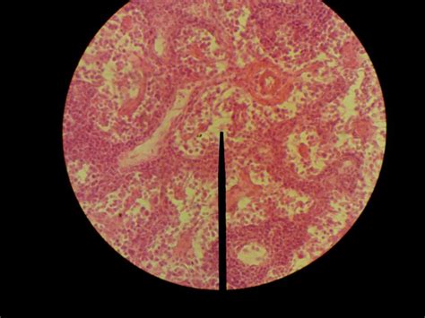 Reticular Connective Tissue Lymph Node