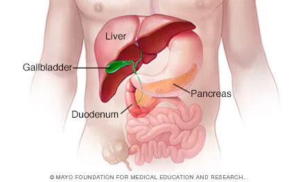 Doing a Coffee Enema without a Gallbladder