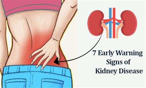 7 Early Signs and Symptoms of Kidney Disease Problems