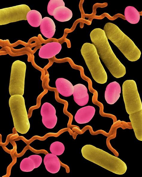 Three Common Types Of Bacterial Morphology Photograph by Dennis Kunkel ...