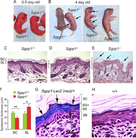 Sgpp1 ؊ / ؊ pups exhibit focal desquamation and abnormal epidermal ...