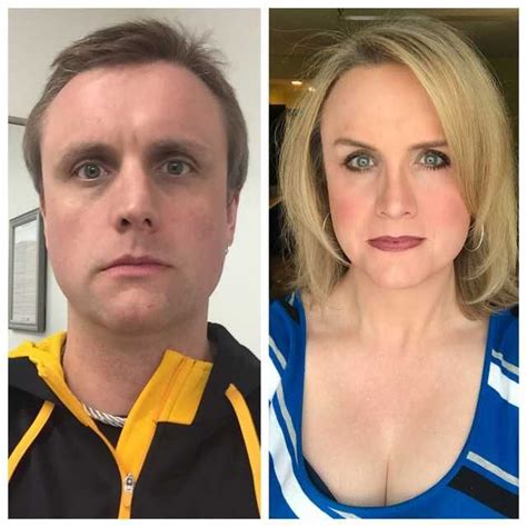 45 - 2Yrs HRT. - Imgur Transgender Before And After, Mtf Before And ...