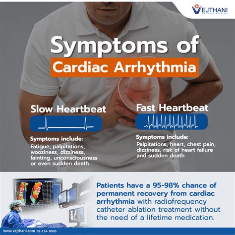 Heart Arrhythmia Symptoms