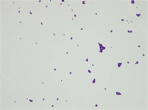 Micrograph Lactococcus lactis gram stain 1000X p000176 | OER Commons