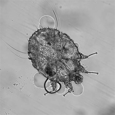 Scabies Eggs Under Microscope