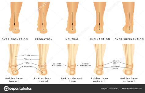 Valgus Vs Varus Of Ankle