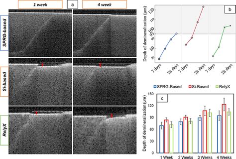 a Typical SS-OCT images of S-PRG-based, Si-based, and RelyX cement ...