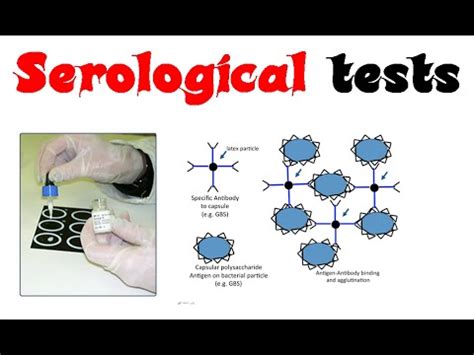 Serological tests - YouTube