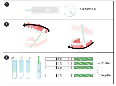 Standard collection scheme for oral HIV self-test (*Adapted from the ...