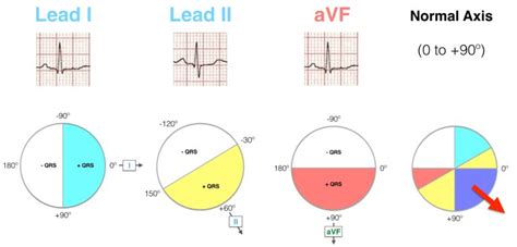 Ekg Axis Graph