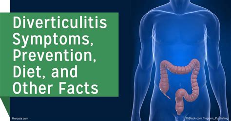 Diverticulitis Symptoms