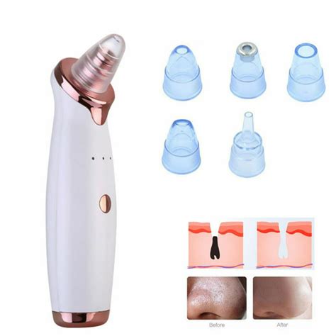 Blackhead Remover Pore Vacuum - Blackhead Removal Tool with 5 ...