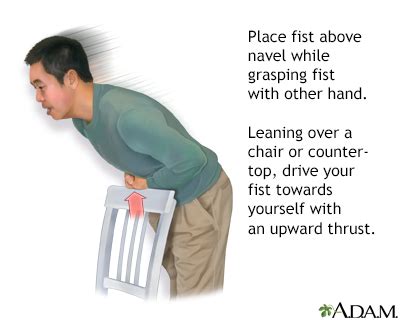 SpecialTopic - Heimlich maneuver on self