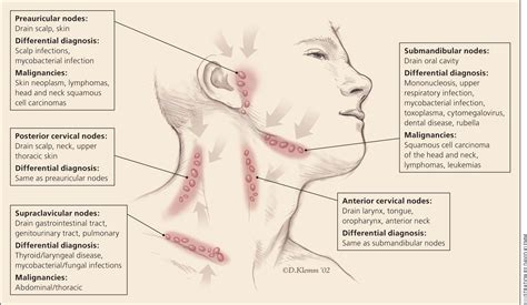 Where are your lymph nodes located - ryteleo