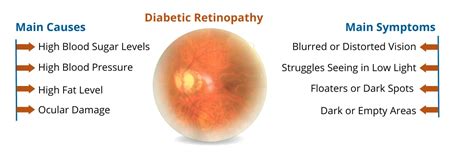 Diabetic Retinopathy Treatment in Delhi with Causes and Stages